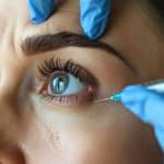 woman receives a cosmetic botox injection